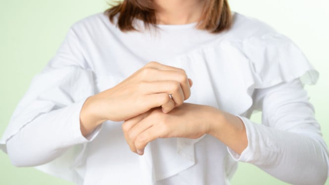 Pengobatan alami untuk meredakan eksim