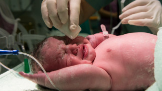 Kenali Komplikasi Bayi Prematur yang Bisa Terjadi