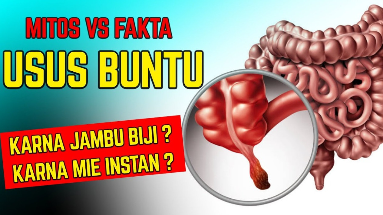 Bukan Hanya Lewat Operasi! Ternyata Begini Cara Menyembuhkan Usus Buntu ...
