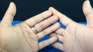 Cincin Macet di Jari? Pakai Trik Sederhana Ini, Gak Perlu Panik!