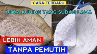 Wauw! Micin Bisa Hilangkan Noda Kuning di Peci Putih, Caranya Mudah Banget!