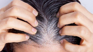 7 Cara Alami Menghitamkan Uban Tanpa Semir Kimia