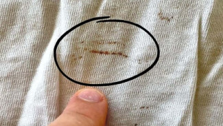 Noda Karat di Baju Bikin Kesel? Coba Cara Ini Biar Hilang Total Tanpa Drama!