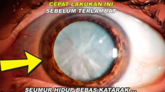 Lakukan Ini di Rumah agar Terhindar dari Katarak!