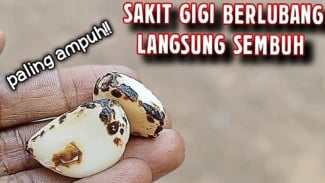 Cara Alami Redakan Sakit Gigi Berlubang Tanpa ke Dokter Dulu, Pakai Minyak Goreng dan Bawang Putih