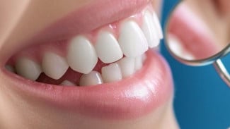 Cara Memutihkan Gigi dengan Whitelight: Praktis dan Hasil Cepat