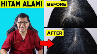 Cara Alami Atasi Rambut Ubanan, Rahasia Bahan Dapur Bisa Bikin Hitam Mengkilap