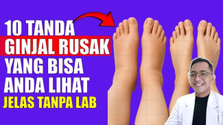 10 Tanda Aneh Tubuh Bisa Jadi Sinyal Ginjal Rusak, Jangan Sepelekan Gejala Ini