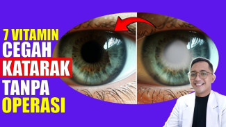 Mata Mulai Kabur? Wajib Coba 7 Vitamin Super Anti Katarak yang Bisa Bikin Penglihatan Tajam Lagi
