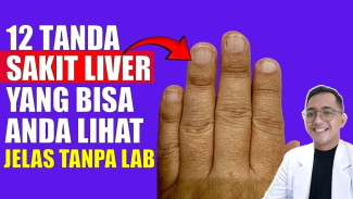 Waspada! Begini 12 Tanda Liver Mulai Rusak yang Bisa Kamu Lihat Sendiri