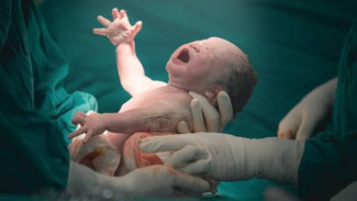 Pertanda Kurang Baik Jika Bayi Lahir Tidak Menangis, Lakukan Hal Ini!
