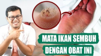 Kaki Nyeri Kayak Diganjal Kerikil? Ketahui 5 Penyebab Mata Ikan yang Wajib Dihindari!
