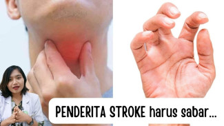 11 Gejala Stroke yang Sering Diabaikan, Nomor 5 Bisa Bikin Kaget Sekeluarga