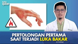Jangan Panik! Begini Pertolongan Pertama Sembuhkan Luka Bakar Tanpa Perih!