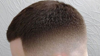 Tips Cepat Menumbuhkan Rambut tanpa Ribet, Dijamin Berhasil 100 Persen!
