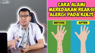Stop Garuk! Ini 5 Cara Paling Cepat dan Nyaman Meredakan Alergi Kulit Secara Alami!
