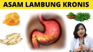 Resep Ajaib! 7 Makanan Alami Ini Bisa Kalahkan Asam Lambung Tanpa Obat Kimia