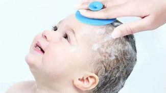5 Cara Mudah Bersihkan Rambut Bayi dari Ketombe, Auto Bersih dan Wangi!