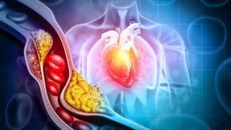 Waspada! Jangan Anggap Remeh, Ini 9 Tanda Kolesterol Tinggi yang Sering Dikira Hanya Pegal Biasa