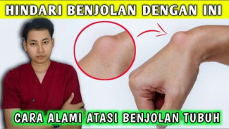 Duh, Ada Benjolan? Ini Trik Ampuh Coba Sikat Pakai Herbal, Nggak Perlu Panik!