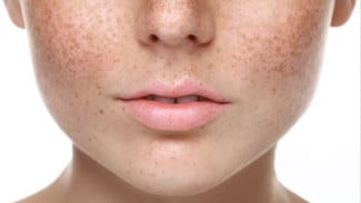 Mau Kulit Cerah dan Flek Hitam Hilang, Coba 6 Herbal Ini Alami Sesuai Anjuran Ahli