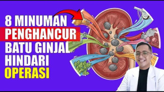 Racikan Rahasia Dokter! Minuman Peluruh Batu Ginjal yang Bisa Bikin Batu Rontok Tanpa Operasi!