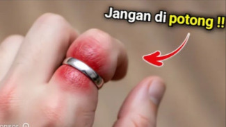 Jangan Panik! Begini Cara Melepaskan Cincin Ketat Tanpa Harus Dipotong