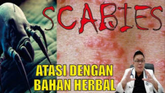 Ternyata Ini Penyebab Kulit Gatal Tak Kunjung Sembuh! Waspada Skabies, Tungau Kecil yang Bisa Hidup di Bawah Kulit!