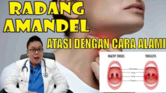 Amandel Bengkak Tak Perlu Panik! Ini 4 Cara Alami Redakan Radang Amandel Tanpa Obat
