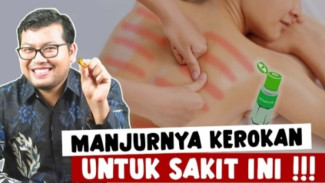 Bukan Angin Lho! Wajib Paham Cara Kerokan Anti-Lecet yang Aman Biar Gak Salah Kaprah!