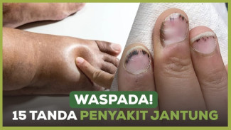Keringat Berlebih Hingga Kaki Bengkak, 15 Gejala Jantung yang Jarang Diketahui Banyak Orang