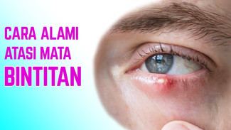 Mata Bengkak Karena Bintitan? Begini 7 Trik Ampuh Biar Cepat Sembuh Total!