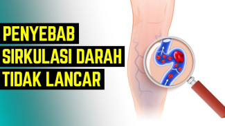 Jangan Sepelekan Kaki Sering Kesemutan, Ini 5 Penyebab Darah Jadi Tidak Lancar!