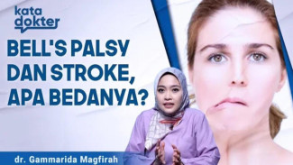 Kelumpuhan Wajah Mendadak: Jangan Panik! Ini Bedanya Bells Palsy dengan Stroke Ringan yang Sering Bikin Salah Diagnosis!