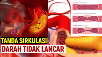 Kulit Pucat dan Mudah Lelah? 11 Tanda Tubuh Sedang Kekurangan Aliran Darah Sehat, Waspada dari Sekarang!