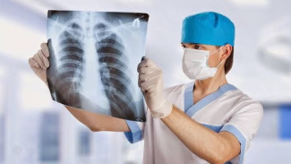 Tidak Pandang Usia, Ini Penyabab Gejala Paru-paru Basah yang Wajib Kamu Ketahui!