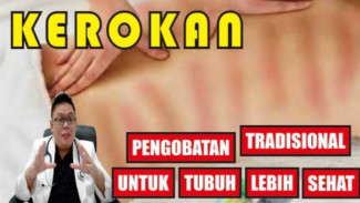 Kerokan Ternyata Punya Manfaat Ilmiah, Nomor 3 Bikin Banyak Orang Kaget!
