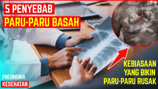 Mulai Cegah Sekarang! 5 Kebiasaan Ini Bisa Picu Paru-Paru Basah hingga Ganggu Aktivitas Sehari-Hari