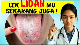 Bahaya! Kenali 9 Tanda di Lidah yang Jadi Gejala Penyakit Serius Jangan Sampai Terlambat!