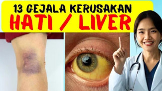 13 Tanda Sepele Ini Jangan Dianggap Remeh! Ini Gejala & Penyebab Kerusakan Hati yang Sering Terlambat Disadari Anak Muda