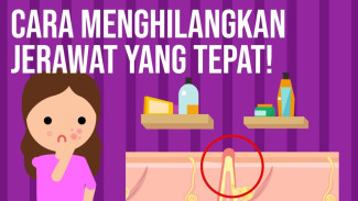 Minyak dan Sel Kulit Mati Menyumbat Bisa Menjadi Jerawat, Jangan Dipencet Pakai Tangan!