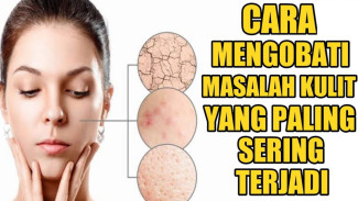 Bercak Putih Tak Hilang Meski Dirawat? Cari Tahu Penyebab Mengejutkan di Balik Perubahan Kulitmu