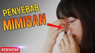 7 Bahan Alami yang Bisa Redakan Gusi Bengkak Lebih Cepat dari Obat Kimia