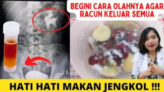 Stop Makan Jengkol Sembarangan! Nyeri Pinggang Sampai Gagal Ginjal Cara Aman Hilangkan 95 Persen Asam Jengkolat