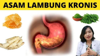 Obat Asam Lambung Alami: Ini 7 Makanan Terbaik dan Bahaya Obat Kimia Jangka Panjang