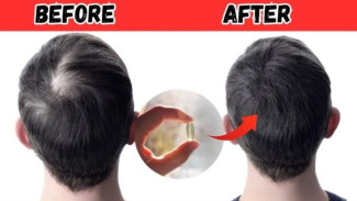 10 Vitamin Ampuh Cegah Kerontokan Rambut, Merawat Sampai ke Akar-akarnya