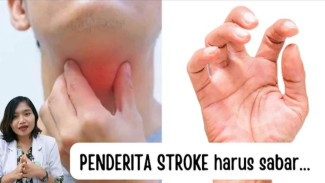 Waspada! 10 Gejala Tak Terduga Pasca-Stroke: Dari Spasme Kaki hingga Gangguan Emosi dan Menelan