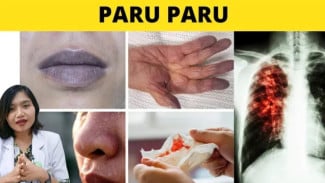 Bukan Sekadar Batuk Biasa! Waspada 10 Tanda Paru-Paru Anda Dalam Bahaya (Kanker, TBC, dll.)