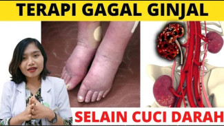 Tiga Jurus Selamat! Pilihan Terapi Gagal Ginjal Kronis yang Bikin Pasien Puyeng, Plus Minus Wajib Tahu!