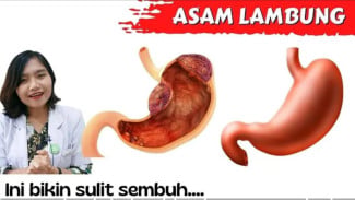 Nggak Mau Kena Siksa Heartburn? 5 Makanan Ajaib Ini Auto Jinakkan Asam Lambung Bandel!